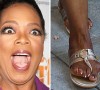 10 Celebrities Who Probably Wish These Shocking Photos Never Surfaced Of Their Ugly Feet